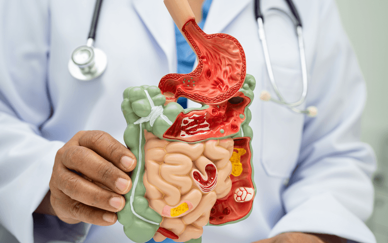 Digestive System Disorders