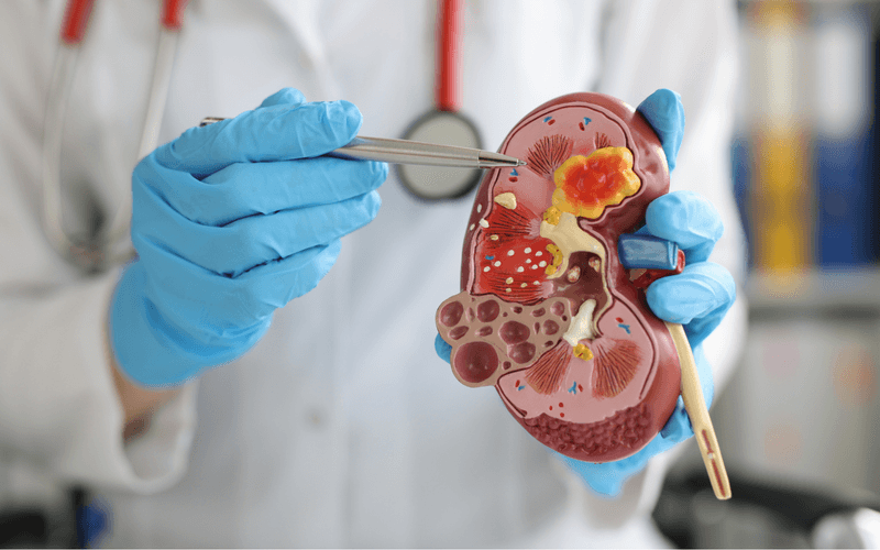 Kidney Failure
